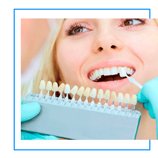 Implantes dentales