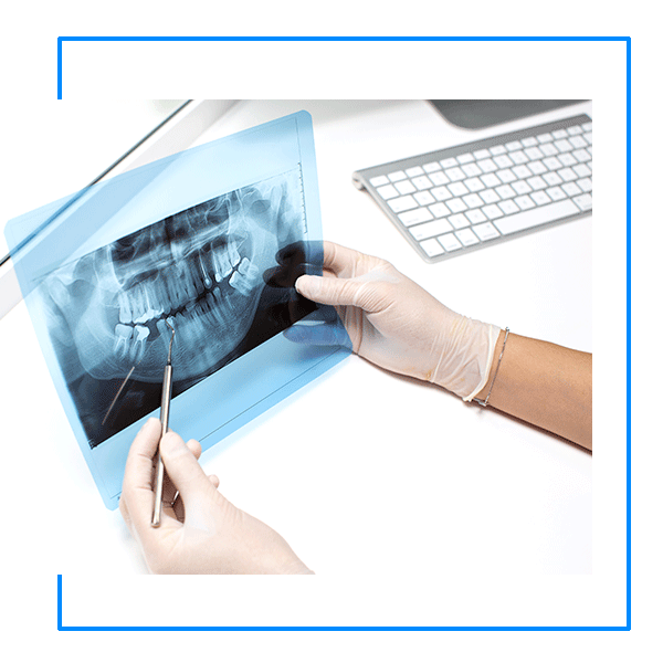 Radiografia Odontológica